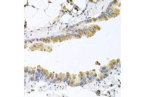 Immunohistochemistry of paraffin-embedded mouse lung using CPA1 antibody. (CPA1 anticorps)