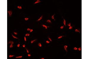 ABIN6266647 staining MCF-7 cells by IF/ICC.