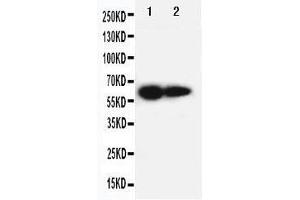 Anti-IL2 Receptor beta antibody, Western blotting Lane 1: PANC Cell Lysate Lane 2: HELA Cell Lysate