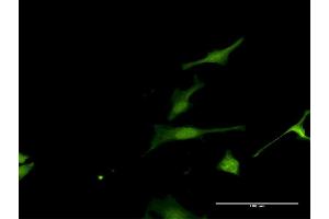 Immunofluorescence of purified MaxPab antibody to FAM117A on HeLa cell. (FAM117A anticorps  (AA 1-453))