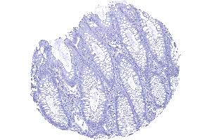 Colon descendes mucosa UPK1b immunostaining is absent in all cells of the colon mucosa (Uroplakin 1B anticorps  (AA 109-229))