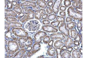 IHC-P Image NNT antibody detects NNT protein at cytosol on mouse kidney by immunohistochemical analysis.