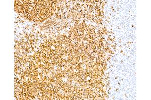 Immunohistochemistry (IHC) image for anti-Membrane-Spanning 4-Domains, Subfamily A, Member 1 (MS4A1) antibody (ABIN7449560) (CD20 anticorps)