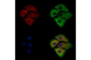 ABIN7094661 and ABIN7098712 staining Hela cells by IF/ICC.