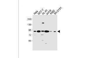 All lanes : Anti-CCNT1 Antibody (Center) at 1:1000 dilution Lane 1: Hela whole cell lysate Lane 2: MCF-7 whole cell lysate Lane 3: HL-60 whole cell lysate Lane 4: Jurkat whole cell lysate Lane 5: K562 whole cell lysate Lane 6: SH-SY5Y whole cell lysate Lysates/proteins at 20 μg per lane. (Cyclin T1 anticorps  (AA 253-281))