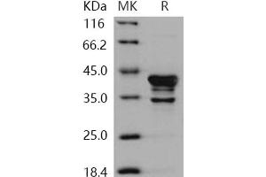 Western Blotting (WB) image for Calcium/calmodulin-Dependent Protein Kinase I (CAMK1) protein (ABIN7317143) (CAMK1 Protéine)