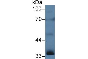 Detection of INHa in Rat Testis lysate using Polyclonal Antibody to Inhibin Alpha (INHa) (Inhibin alpha anticorps  (AA 25-363))