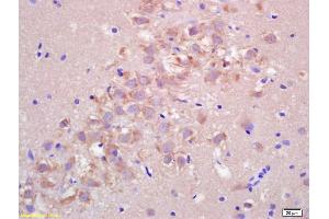 Formalin-fixed and paraffin embedded rat brain labeled with Rabbit Anti FIS1/TTC11 Polyclonal Antibody, Unconjugated (ABIN872461) at 1:200 followed by conjugation to the secondary antibody and DAB staining