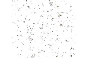 Immunocytochemistry (ICC) image for anti-N-Myc Proto-Oncogene Protein (MYCN) (AA 100-150) antibody (ABIN7795786) (Recombinant MYCN anticorps  (AA 100-150))