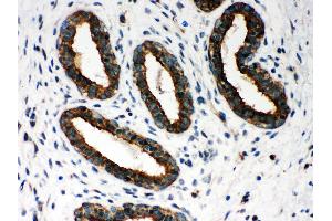 Anti- Peroxiredoxin 1 Picoband antibody, IHC(P) IHC(P): Huma Mammary Cancer Tissue (Peroxiredoxin 1 anticorps  (Middle Region))