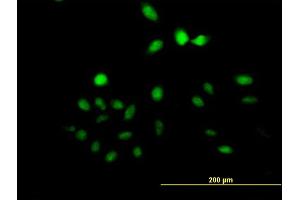 Immunofluorescence of purified MaxPab antibody to UTP11L on HeLa cell. (UTP11L anticorps  (AA 1-253))