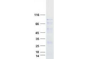 Validation with Western Blot