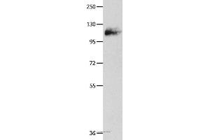 Western blot analysis of Mouse lung tissue, using AMPH Polyclonal Antibody at dilution of 1:500 (Amphiphysin anticorps)