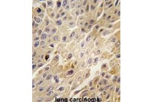 Immunohistochemistry (IHC) image for anti-Adrenergic, Beta, Receptor Kinase 1 (ADRBK1) antibody (ABIN3002924)
