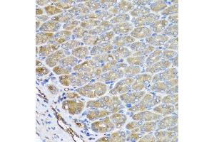 Immunohistochemistry of paraffin-embedded mouse stomach using VPS37A antibody at dilution of 1:100 (x40 lens). (VPS37A anticorps)