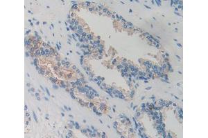 Used in DAB staining on fromalin fixed paraffin- embedded Kidney tissue