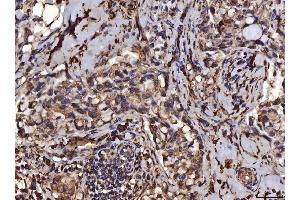 IHC analysis of PDIA6 using anti-PDIA6 antibody (ABIN7600554). (PDIA6 anticorps  (AA 20-440))