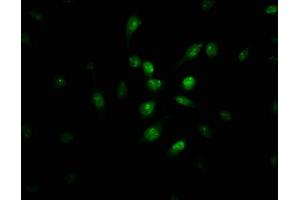 Immunofluorescence staining of U251 cells with ABIN7163461 at 1:100, counter-stained with DAPI. (Pirin anticorps  (AA 1-290))