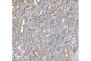 IHC analysis of SND1 using anti-SND1 antibody (ABIN7600526). (SND1 anticorps  (AA 20-204))