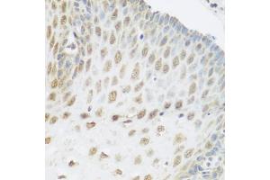 Immunohistochemistry of paraffin-embedded human esophagus using SNAI1 antibody (ABIN5975364) at dilution of 1/100 (40x lens). (SNAIL anticorps)