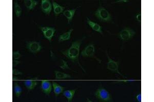 Immunofluorescence analysis of L929 cells using SRPRB Polyclonal Antibody at dilution of 1:100. (SRPRB anticorps)