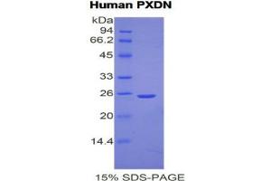 SDS-PAGE (SDS) image for Peroxidasin Homolog (PXDN) (AA 76-260) protein (His tag) (ABIN1877678) (Peroxidasin Protein (AA 76-260) (His tag))