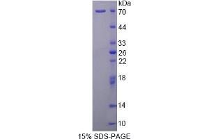 Image no. 1 for CD93 (CD93) (AA 227-493) protein (His tag,GST tag) (ABIN6237729)
