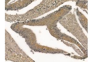 ST13 Mouse Monoclonal Antibody at 1/100 staining rat colorectal tissue by IHC-P. (HSC70 Interacting Protein HIP anticorps)