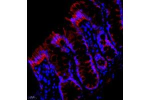 Immunofluorescent analysis of paraffin embedded rat colon using PMCA1 (ABIN7073155) at dilution of 1: 500 (ATP2B1 anticorps)