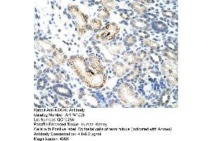 Rabbit Anti-NOC4L Antibody  Paraffin Embedded Tissue: Human Kidney Cellular Data: Epithelial cells of renal tubule Antibody Concentration: 4. (NOC4L anticorps  (C-Term))
