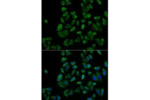 Immunofluorescence analysis of HeLa cells using PEX5 antibody (ABIN6133015, ABIN6145469, ABIN6145471 and ABIN6221464).