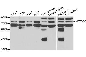 Western blot analysis of extracts of various cell lines, using KBTBD7 antibody (ABIN5975133) at 1/1000 dilution. (KBTBD7 anticorps)