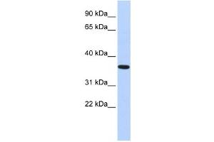 Western Blotting (WB) image for anti-CPX Chromosome Region, Candidate 1 (CPXCR1) antibody (ABIN2458436) (CPXCR1 anticorps)