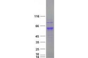 Validation with Western Blot