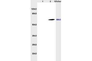 Lane 1: rat brain lysates Lane 2: human colon carcinoma lysates probed with Anti CD98 Polyclonal Antibody, Unconjugated (ABIN719546) at 1:200 in 4 °C. (SLC3A2 anticorps  (AA 231-280))