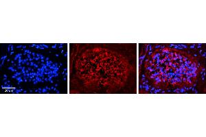 Rabbit Anti-XPO1 Antibody     Formalin Fixed Paraffin Embedded Tissue: Human Pineal Tissue  Observed Staining: Cytoplasmic in pinealocytes  Primary Antibody Concentration: 1:100  Other Working Concentrations: 1/600  Secondary Antibody: Donkey anti-Rabbit-Cy3  Secondary Antibody Concentration: 1:200  Magnification: 20X  Exposure Time: 0.