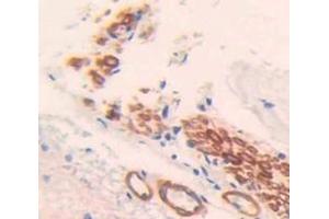 Used in DAB staining on fromalin fixed paraffin- embedded Kidney tissue (TMEFF1 anticorps  (AA 58-312))