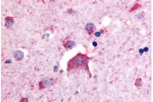 Anti-DPP6 antibody  ABIN1048510 IHC staining of human brain, neurons. (DPP6 anticorps  (Internal Region))