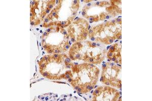 Immunohistochemical analysis of paraffin-embedded H. (BCL10 anticorps  (AA 1-143))