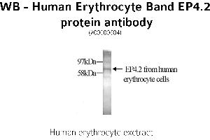 Image no. 1 for anti-erythrocyte Membrane Protein Band 4.2 (EPB42) antibody (ABIN346968) (EPB42 anticorps)