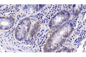 Detection of CASP6 in Bovine Colon Tissue using Polyclonal Antibody to Caspase 6 (CASP6)