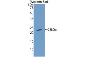 Western blot analysis of the recombinant protein. (Cardiotrophin 1 anticorps  (AA 1-201))