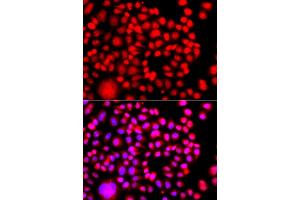 Immunofluorescence analysis of A549 cells using TESK2 antibody (ABIN6292305).