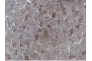 Detection of UBE2L3 in Human Liver Tissue using Polyclonal Antibody to Ubiquitin Conjugating Enzyme E2L3 (UBE2L3)