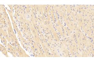 Detection of BNP in Mouse Cardiac Muscle Tissue using Polyclonal Antibody to Brain Natriuretic Peptide (BNP) (BNP anticorps  (AA 77-121))