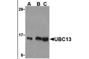 Western Blotting (WB) image for anti-Ubiquitin-Conjugating Enzyme E2N (UBE2N) (C-Term) antibody (ABIN1030789)