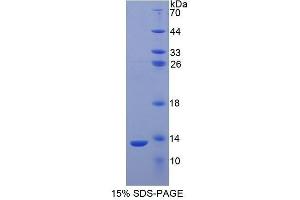 SDS-PAGE (SDS) image for S100 Calcium Binding Protein A2 (S100A2) (AA 2-98) protein (His tag) (ABIN1080712)