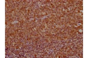IHC image of ABIN7163895 diluted at 1:100 and staining in paraffin-embedded human tonsil tissue performed on a Leica BondTM system.
