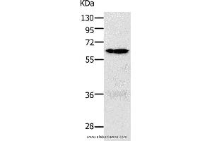 Western blot analysis of 293T and K562 cell, using PAK1 Polyclonal Antibody at dilution of 1:700 (PAK1 anticorps)