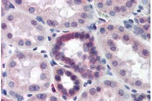 Human Kidney (formalin-fixed, paraffin-embedded) stained with CAND2 antibody ABIN218497 at 1:500 followed by biotinylated goat anti-rabbit IgG secondary antibody ABIN481713, alkaline phosphatase-streptavidin and chromogen. (CAND2 anticorps  (C-Term))